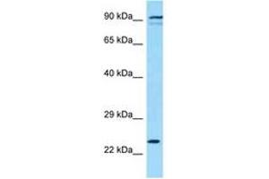 Image no. 1 for anti-Killer Cell Lectin-Like Receptor Subfamily K, Member 1 (KLRK1) (AA 121-170) antibody (ABIN6748394)