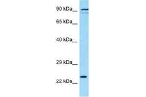Image no. 1 for anti-Killer Cell Lectin-Like Receptor Subfamily K, Member 1 (KLRK1) (AA 121-170) antibody (ABIN6748394) (KLRK1 anticorps  (AA 121-170))