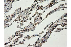 Image no. 9 for anti-Catalase (CAT) antibody (ABIN1497109)