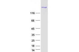 Validation with Western Blot