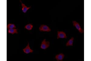 ABIN6264524 and ABIN6272977 staining HepG2 by IF/ICC.