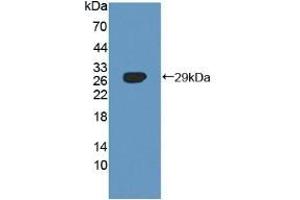 Detection of Recombinant SNX13, Human using Polyclonal Antibody to Sorting Nexin 13 (SNX13) (SNX13 anticorps  (AA 97-284))