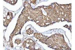 IHC analysis of MFF using anti-MFF antibody (ABIN7599292). (MFF anticorps  (AA 1-342))