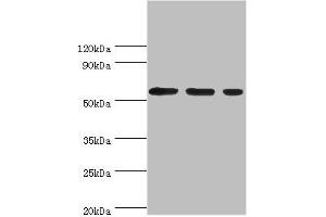 Western blot All lanes: Aladin antibody at 5 μg/mL Lane 1: Hela whole cell lysate Lane 2: Mouse brain tissue Lane 3: NIH/3T3 whole cell lysate Secondary Goat polyclonal to rabbit IgG at 1/10000 dilution Predicted band size: 60, 56 kDa Observed band size: 60 kDa (Adracalin anticorps  (AA 287-546))