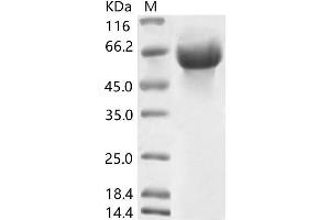 Western Blotting (WB) image for Coronavirus OC43 Hemagglutinin Esterase (HCoV-OC43 HE) protein (His tag) (ABIN7198833) (HCoV-OC43 HE Protein (His tag))