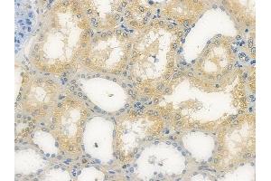 ABIN7096416 and ABIN7100480 at 1/100 staining human normal kidney tissue by IHC-P. (FBXL2 anticorps)