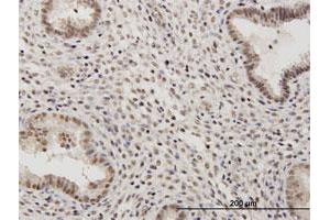 Immunoperoxidase of purified MaxPab antibody to RSC1A1 on formalin-fixed paraffin-embedded human endometrium. (RSC1A1 anticorps  (AA 1-617))
