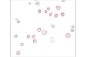 anti-FRAS1 Related Extracellular Matrix 1 (FREM1) (C-Term) antibody