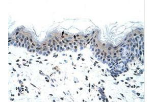 Image no. 1 for anti-Sodium Channel, Voltage-Gated, Type V, alpha Subunit (SCN5A) (AA 1856-1905) antibody (ABIN6736314)