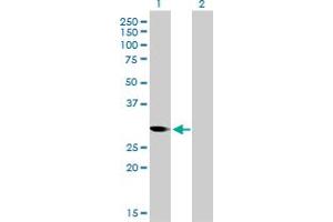 Western Blot analysis of CDC2 expression in transfected 293T cell line by CDC2 monoclonal antibody (M01), clone 1A4-1A9. (CDK1 anticorps  (AA 1-297))