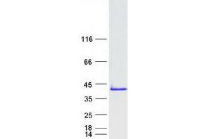 Validation with Western Blot