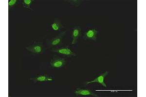 Immunofluorescence of purified MaxPab antibody to SUMO2 on HeLa cell.