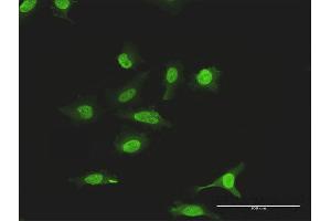 Immunofluorescence of purified MaxPab antibody to SUMO2 on HeLa cell. (SUMO2 anticorps  (AA 1-95))