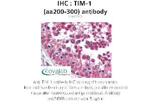 Image no. 1 for anti-Hepatitis A Virus Cellular Receptor 1 (HAVCR1) (AA 200-300) antibody (ABIN1740077) (HAVCR1 anticorps  (AA 200-300))