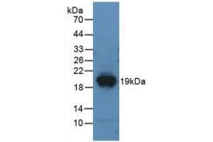 Western blot analysis of recombinant Mouse DPP4. (DPP4 anticorps  (AA 29-178))