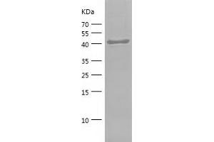 Western Blotting (WB) image for CD44 (CD44) (AA 152-311) protein (His-IF2DI Tag) (ABIN7122208)