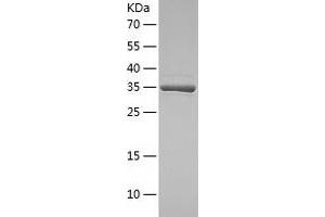 Western Blotting (WB) image for Histo-blood group A transferase (ABO) (AA 54-354) protein (His-IF2DI Tag) (ABIN7122005)
