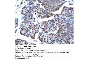 Human Pancreas (CTBP1 anticorps  (C-Term))