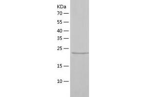 Western Blotting (WB) image for X-Linked Inhibitor of Apoptosis (XIAP) (AA 120-356) protein (His-IF2DI Tag) (ABIN7125749)