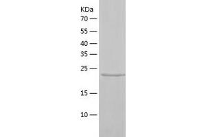Western Blotting (WB) image for X-Linked Inhibitor of Apoptosis (XIAP) (AA 120-356) protein (His tag) (ABIN7125749)