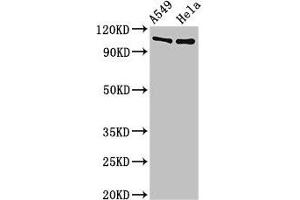Western Blot Positive WB detected in: A549 whole cell lysate, Hela whole cell lysate All lanes: EML4 antibody at 3 μg/mL Secondary Goat polyclonal to rabbit IgG at 1/50000 dilution Predicted band size: 109, 103 kDa Observed band size: 109 kDa (EML4 anticorps  (AA 1-62))