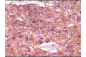 Immunohistochemistry (IHC) image for anti-Steroid Receptor RNA Activator 1 (SRA1) (truncated) antibody (ABIN2464107)