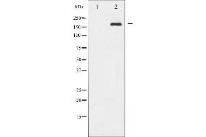 Western blot analysis of IRS-1 phosphorylation expression in 293 whole cell lysates,The lane on the left is treated with the antigen-specific peptide.