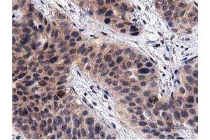 Image no. 3 for anti-Acyl-CoA Thioesterase 12 (ACOT12) antibody (ABIN1496414) (ACOT12 anticorps)