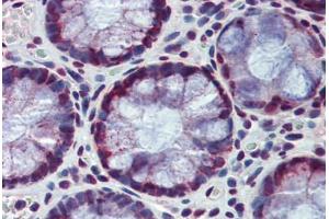 Human Colon: Formalin-Fixed, Paraffin-Embedded (FFPE)