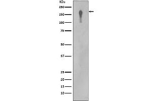 Western blot analysis of EGFR in A431 cell lysate. (Recombinant EGFR anticorps)