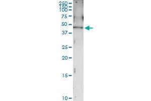 Immunoprecipitation of MAGEA4 transfected lysate using anti-MAGEA4 MaxPab rabbit polyclonal antibody and Protein A Magnetic Bead , and immunoblotted with MAGEA4 MaxPab mouse polyclonal antibody (B01) .