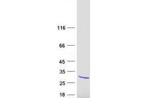 Validation with Western Blot