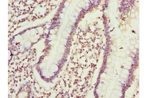 Immunohistochemistry of paraffin-embedded human small intestine tissue using ABIN7164405 at dilution of 1:100