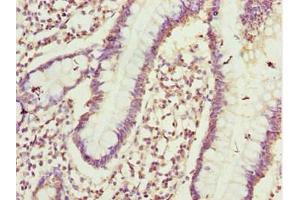 Immunohistochemistry of paraffin-embedded human small intestine tissue using ABIN7164405 at dilution of 1:100 (CIAO1 anticorps  (AA 1-339))