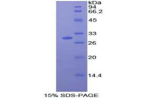SDS-PAGE analysis of Human MAPK11 Protein.