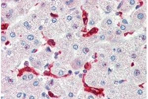 Human Liver (formalin-fixed, paraffin-embedded) stained with HMOX1 antibody ABIN462109 at 10 ug/ml followed by biotinylated goat anti-rabbit IgG secondary antibody ABIN481713, alkaline phosphatase-streptavidin and chromogen.