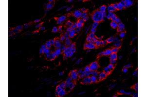 Immunofluorescence (IF) image for anti-Dedicator of Cytokinesis 4 (DOCK4) (AA 1725-1775) antibody (ABIN7448952)