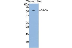 Western Blotting (WB) image for anti-Laminin, beta 1 (LAMB1) (AA 1053-1258) antibody (ABIN1859602) (Laminin beta 1 anticorps  (AA 1053-1258))