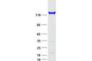 Validation with Western Blot