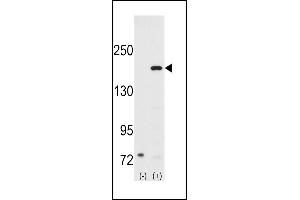 Western blot analysis of SRC1 (arrow) using rabbit polyclonal SRC1 Antibody (N-term) (ABIN391824 and ABIN2841669). (NCOA1 anticorps  (N-Term))