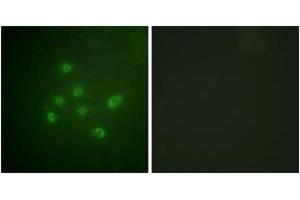 Immunofluorescence analysis of A549 cells, using DAPK3 (Phospho-Thr265) Antibody. (DAPK3 anticorps  (pThr265))