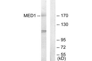 Western blot analysis of extracts from Jurkat cells, using MED1 antibody. (MED1 anticorps  (Internal Region))