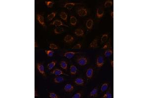 Immunofluorescence analysis of U-2 OS cells using TCIRG1 Polyclonal Antibody (ABIN7270707) at dilution of 1:100 (40x lens).