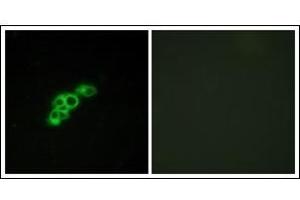 Immunofluorescence analysis of MCF7 cells, using FSHR Antibody. (FSHR anticorps  (Internal Region))