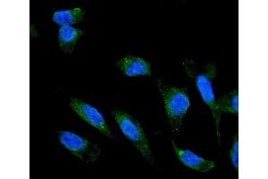 IF analysis of ADIPOR1 using anti-ADIPOR1 antibody (ABIN3043520).