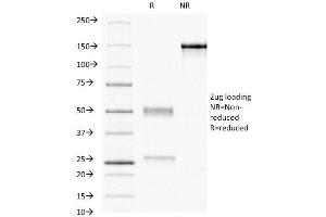 SDS-PAGE Analysis Purified Progesterone Receptor Mouse Monoclonal Antibody (PR484).