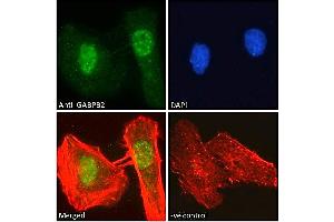 ABIN190778 Immunofluorescence analysis of paraformaldehyde fixed HeLa cells, permeabilized with 0. (GABPB2 anticorps  (Internal Region))