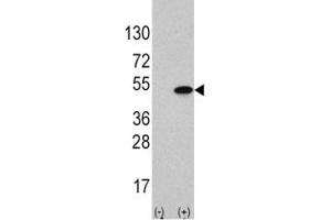 Western blot analysis of ATF4 antibody and 293 cell lysate (2 ug/lane) either nontransfected (Lane 1) or transiently transfected with the ATF4 gene (2). (ATF4 anticorps  (AA 220-252))
