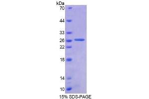 SDS-PAGE analysis of Human AUP1 Protein. (Ancient Ubiquitous Protein 1 Protein (Aup1))