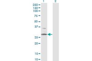 Western Blot analysis of HSD11B1 expression in transfected 293T cell line by HSD11B1 monoclonal antibody (M02A), clone 2C10.
